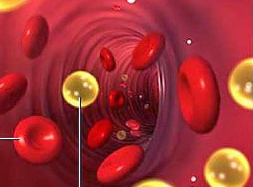 Sau tuổi 50, vì sao người gầy vẫn có thể tăng triglyceride? - Ảnh 3.