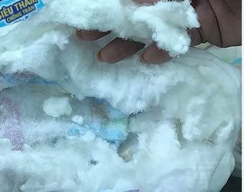 Bỉm nhái, kém chất lượng có thể gây mẩn ngứa, viêm da, nhiễm trùng tại cơ quan sinh dục.
