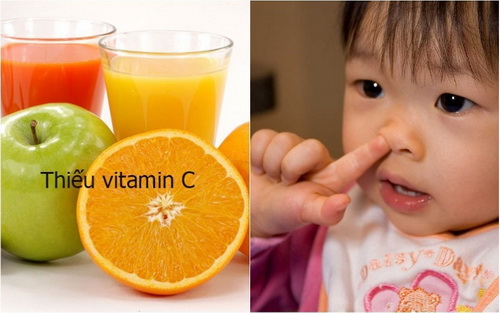 Nên cho trẻ ăn các thức thanh mát, rau xanh, quả tươi giàu vitamin C như quýt, cà chua… để phòng ngừa chảy máu cam.