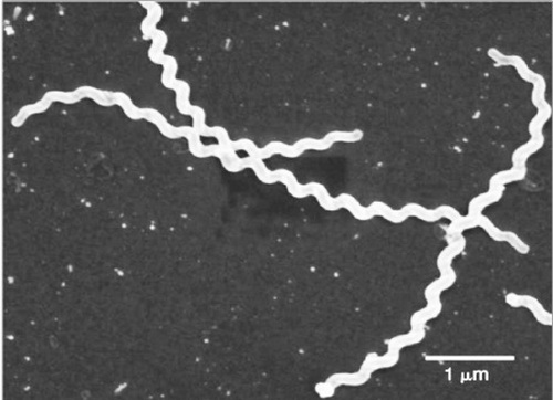 Xoắn khuẩn Leptospira gây bệnh vàng da.