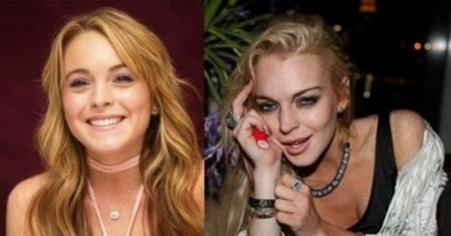 Dung nhan trước và sau khi sử dụng ma túy của Lindsay Lohan, nữ diễn viên nhí từng nổi tiếng một thời.