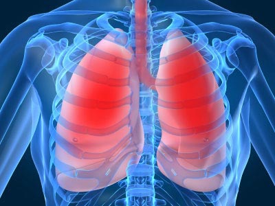 Viêm mủ màng phổi: dễ bỏ sót, nhiều tai biến