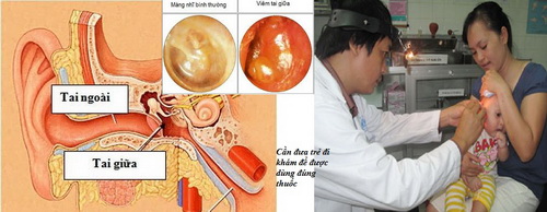 Cần đưa trẻ đi khám để được dùng đúng thuốc.