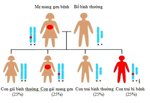 Sơ đồ di truyền bệnh Hemophilia.