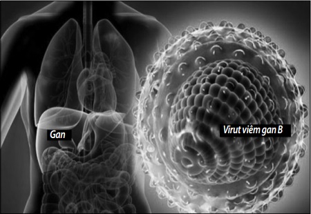 Virut gây bệnh viêm gan B.