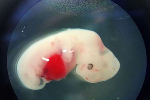 Chỉnh sửa bộ gene CRISPR Chỉnh sửa bộ gene CRISPR
