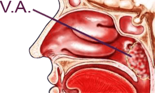 Vị trí của tổ chức VA.