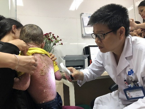 Khám cho bệnh nhân bị vẩy nến tại BV Da liễu Trung ương.
