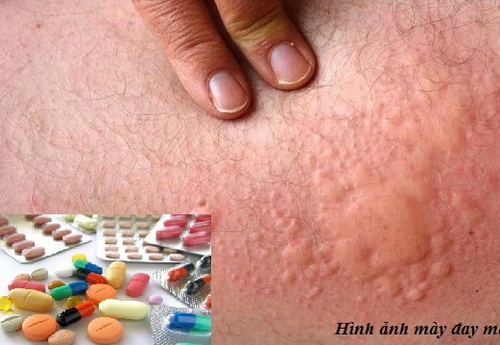Người bệnh cần dùng thuốc theo chỉ định của bác sĩ.