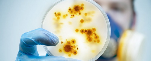 Bacillus có hình que nhưng khi bị bỏ đói, chúng co lại cho đến khi gần như có hình cầu.