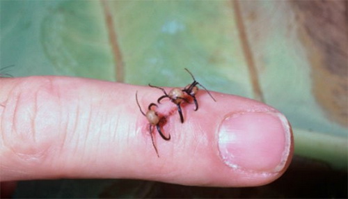 Kiến khâu vết thương.
