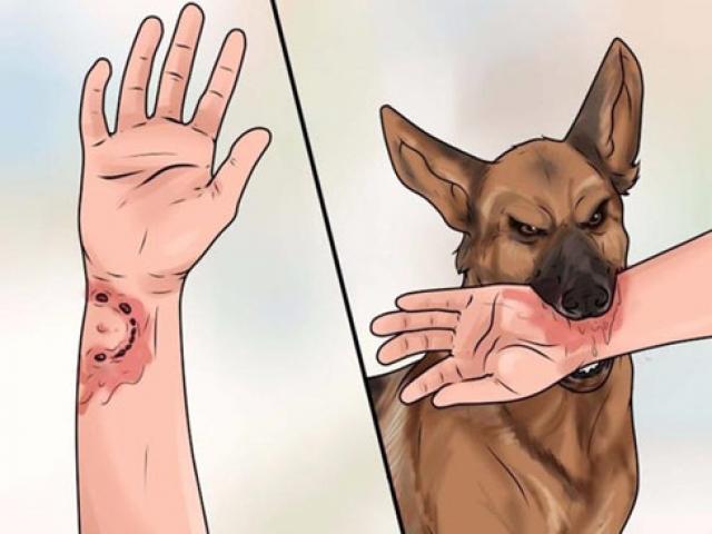 Khi bị chó cắn cần dùng dung dịch khử trùng để rửa vết thương.