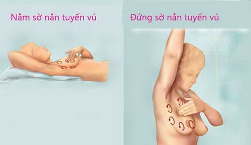 Để phát hiện sớm căn bệnh về vú, các chị em nên tự khám vú sau chu kỳ kinh nguyệt khoảng 5 ngày.
