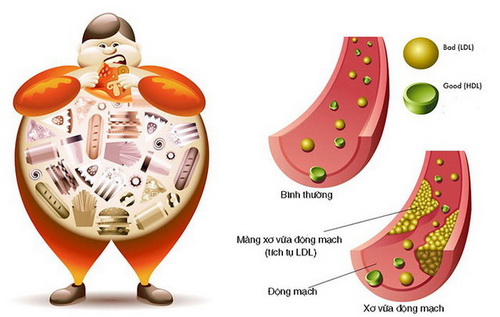 Khi bị tăng mỡ máu, cần có chế độ ăn uống và sinh hoạt hợp lý.