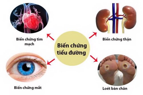 Một số biến chứng do đái tháo đường.