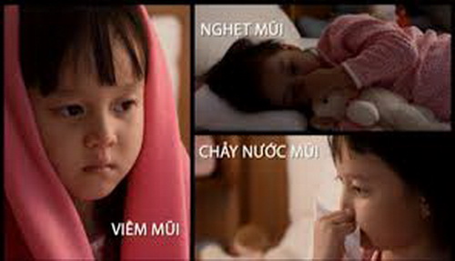 Một số triệu chứng khi bị viêm mũi dị ứng.