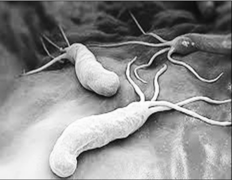 Vi khuẩn H. pylori.