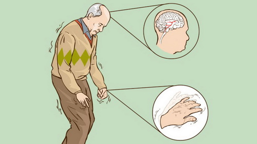 Các thuốc trị Parkinson hiện nay nhắm vào các triệu chứng và giúp người bệnh có thể kiểm soát tốt nhất tình trạng của mình.