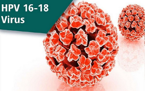 Nhiễm Human Papilloma virus (HPV) là 1 trong 4 STD không thể chữa khỏi.