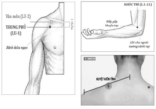 Xoa bóp một số huyệt giúp giảm đau quanh khớp vai.