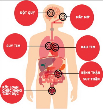 Phòng ngừa tăng huyết áp đột ngột