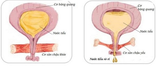 Một số thuốc có thể tác động đến cơ bàng quang gây tiểu tiện không tự chủ.