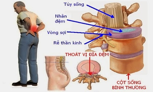 Vị trí huyệt thận du.