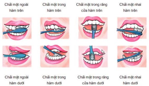 Vệ sinh răng miệng hàng ngày, đúng cách phòng viêm nhiễm hàm mặt.