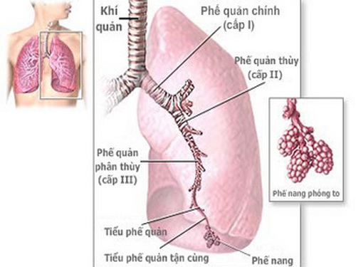 Viêm phế quản dễ gặp vào mùa đông - xuân. Viêm phế quản dễ gặp vào mùa đông - xuân.