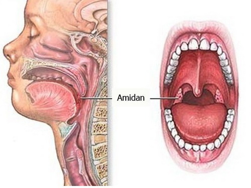 Amindan nằm ở ngã tư hầu họng, là cửa ngõ bảo vệ đường hô hấp, nên dễ bị vi khuẩn tấn công và gây viêm.