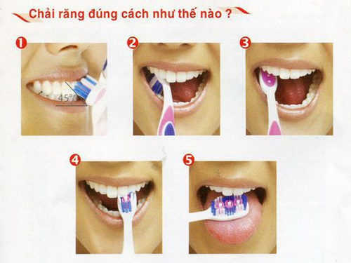 Các bước chải răng đúng.