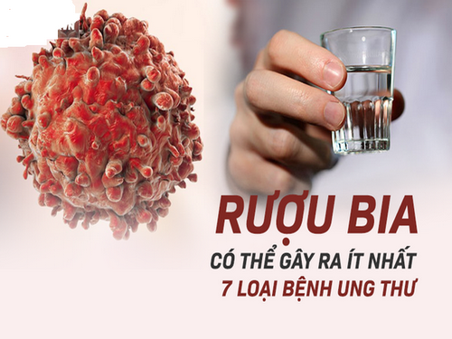 Rượu gây nhiều tác hại cho sức khỏe, trong đó có ung thư.