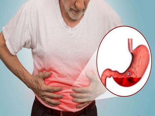 Uống quá nhiều vitamin C gây rối loạn chức năng dạ dày.