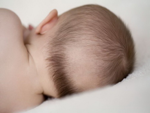 Tư thế nằm ngủ ảnh hưởng tới sự rụng tóc ở trẻ.