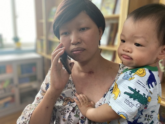 Bệnh nhân Nguyễn Thị Liên khỏe mạnh hồi sinh kỳ diệu sau những nỗ lực điều trị của các y bác sĩ Bệnh viện K.