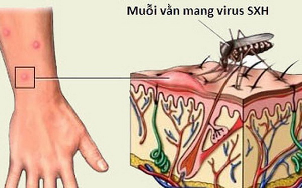 Muỗi vằn truyền bệnh sốt xuất huyết cho con người.