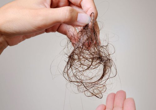 Hiện tượng rụng tóc nhiều của nam giới Nguyên nhân và cách khắc phục