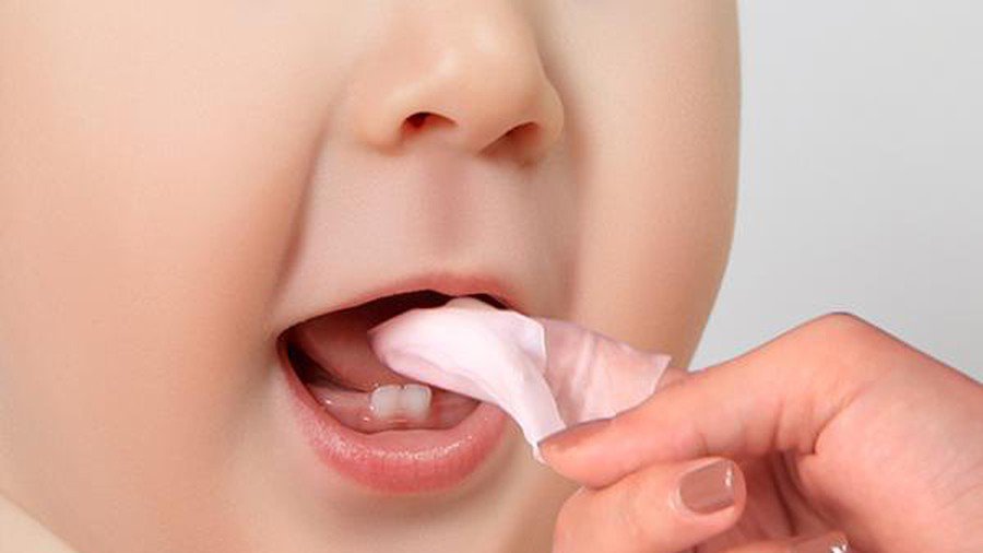Cách xử trí bệnh nấm lưỡi ở trẻ nhỏ
