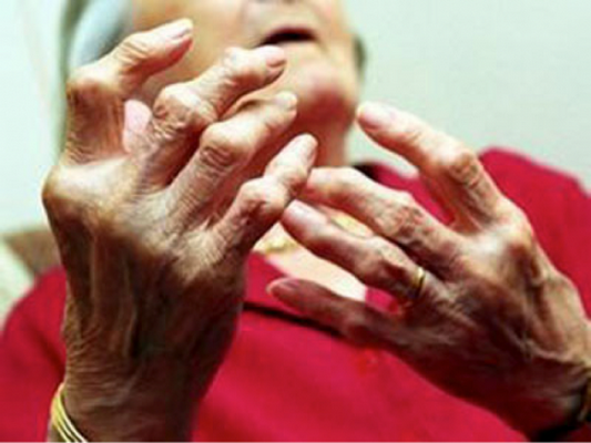 Lá ngũ gia bì có tác dụng gì với sức khỏe?- Ảnh 2. Ngũ gia bì trị phong thấp, chấn thương đụng giập