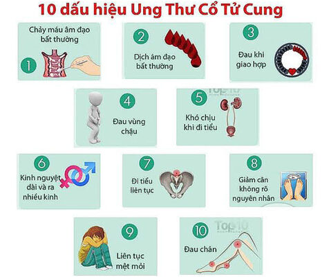 10 dấu hiệu ung thư cổ tử cung.