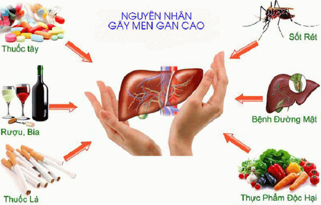 Một số yếu tố khiến men gan tăng cao.