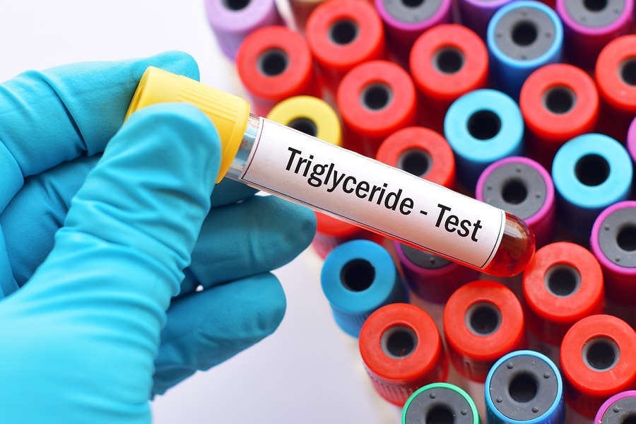 Có thể xác định chỉ số triglyceride thông qua xét nghiệm máu.