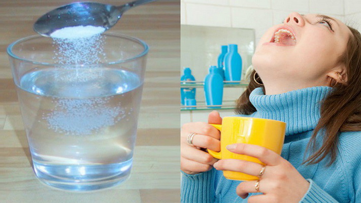 Súc miệng bằng nước muối sinh lý đã trở thành một phương pháp dự phòng phổ biến cho một số vấn đề khó chịu ở khoang miệng - họng.