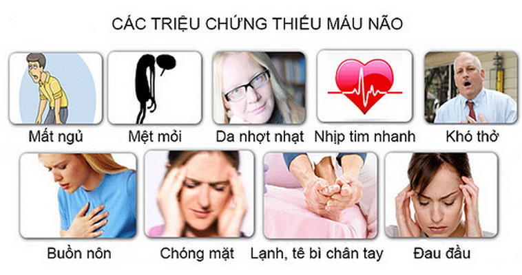 Các triệu chứng của bệnh thiếu máu.