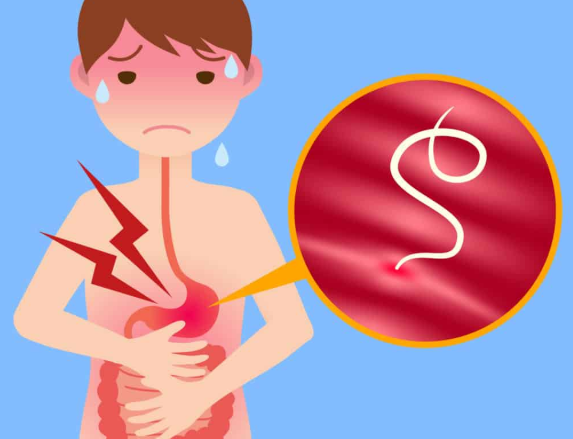 Phòng nhiễm giun móc ở trẻ