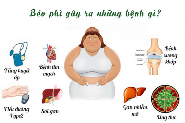 Béo phì là nguy cơ dẫn đến bệnh và các giải pháp phòng ngừa hiệu quả