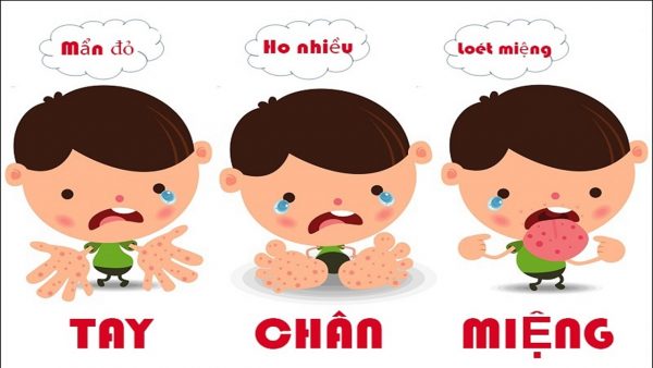 Dấu hiệu nhận biết bệnh TCM