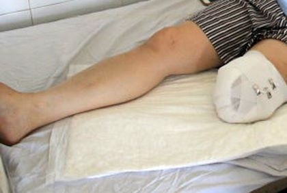 Nhân viên y tế tự cắt chân của mình