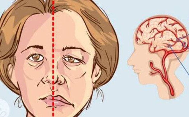 7. Tầm quan trọng của việc hiểu biết về bệnh trúng phong