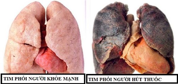 tim phổi của người hút thuốc lá